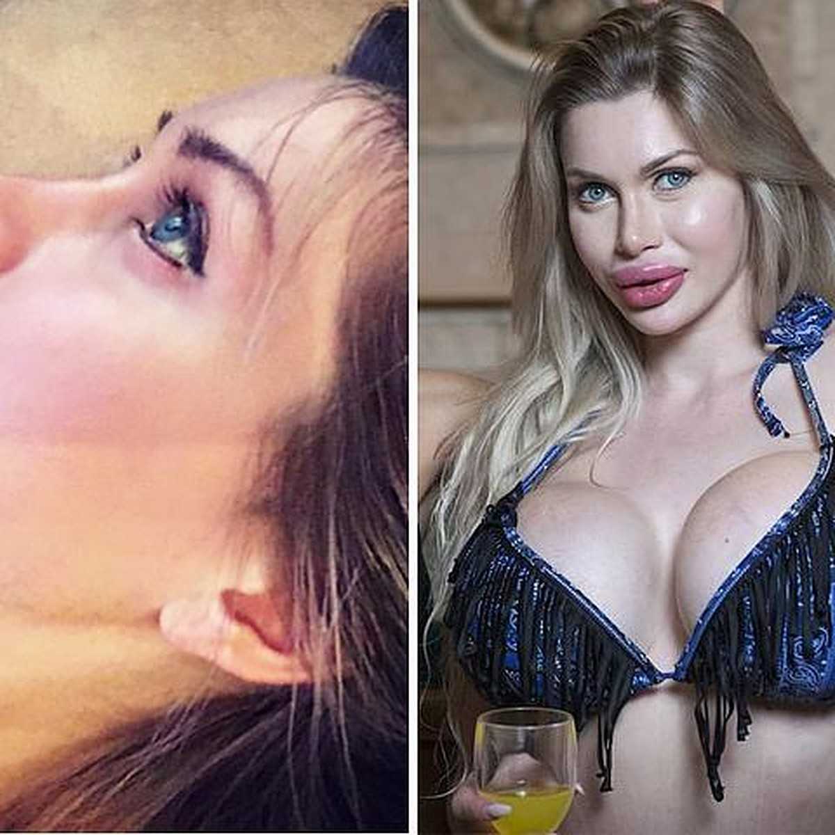 Аурика алехина: какие пластические операции сделала жена станислава бондаренко + видео